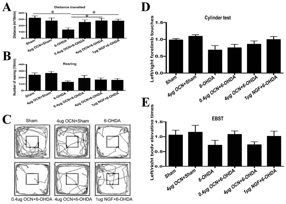 Application of osteocalcin in preparing medicine for treating Parkinson's disease