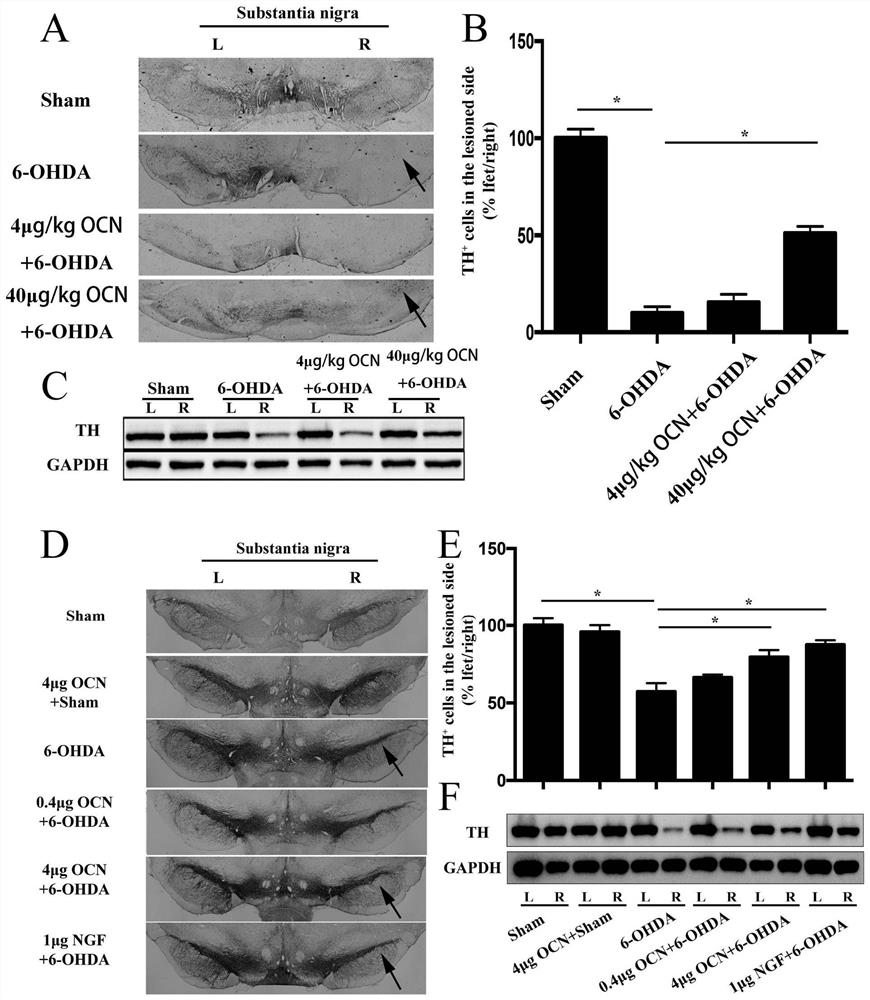 Application of osteocalcin in preparing medicine for treating Parkinson's disease