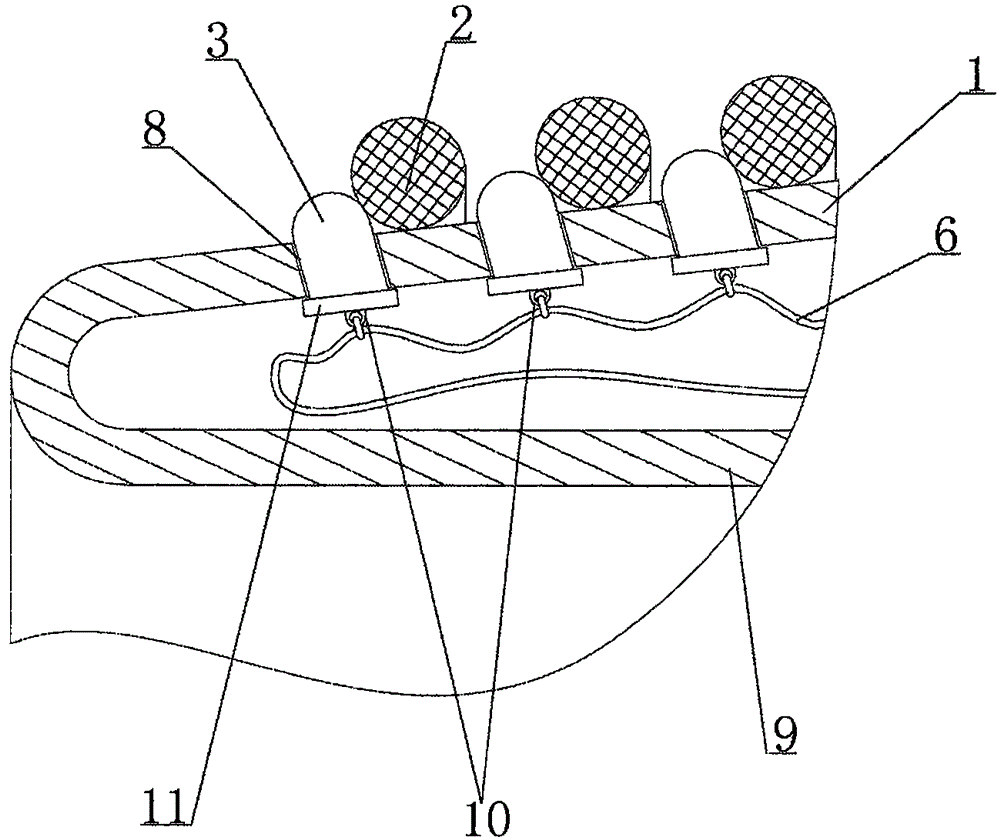 Endoscopic esophageal variceal ligation apparatus