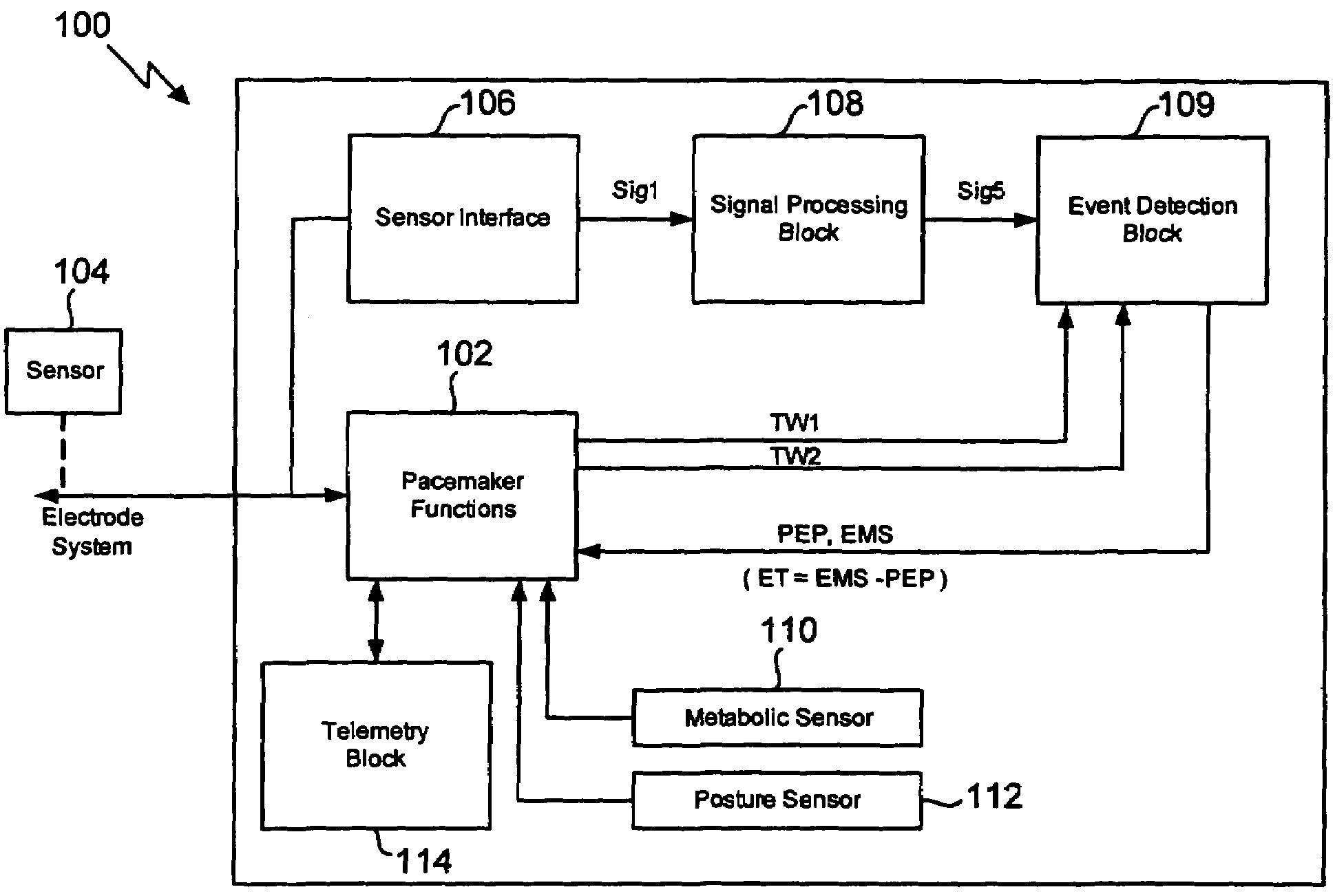 Method for extracting timing parameters using a cardio-mechanical sensor