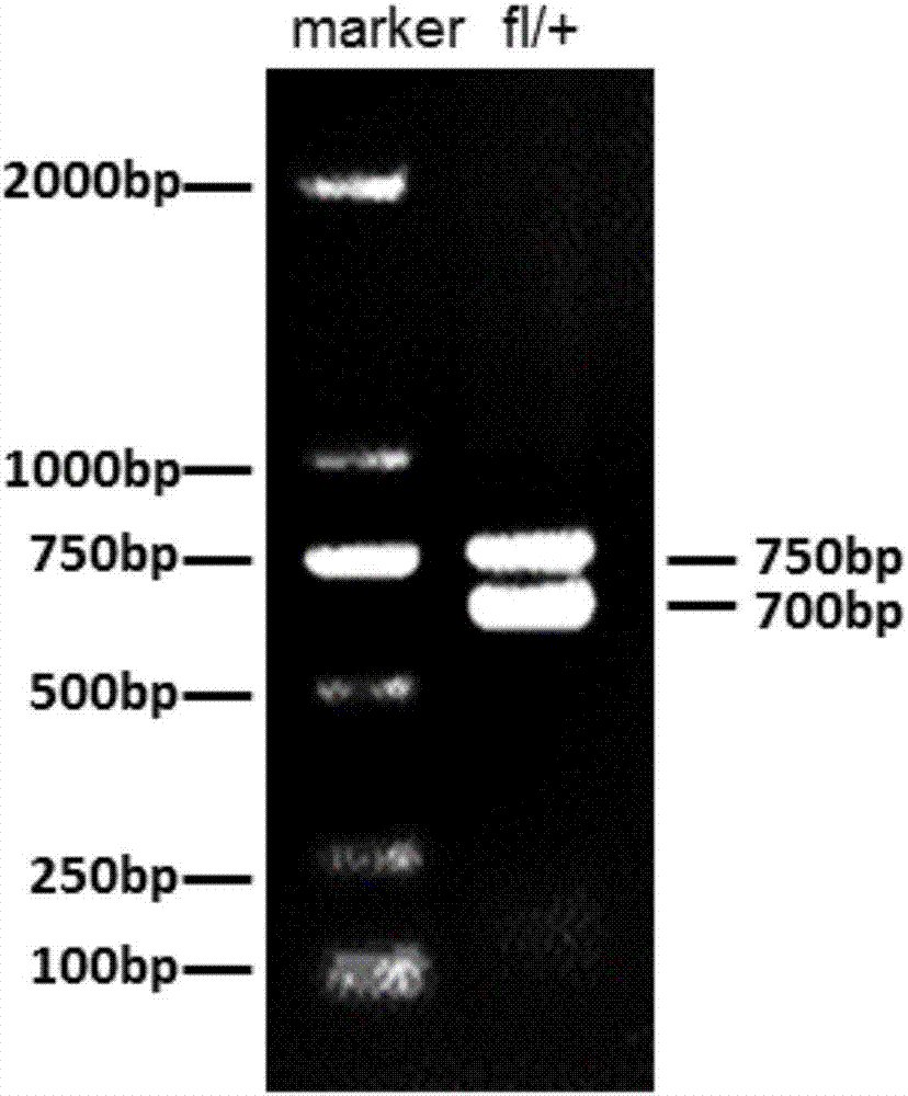 Construction and application of mouse model with conditional knockout of MACF1 gene in osteoblast