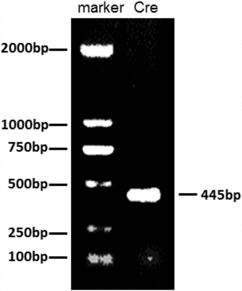 Construction and application of mouse model with conditional knockout of MACF1 gene in osteoblast