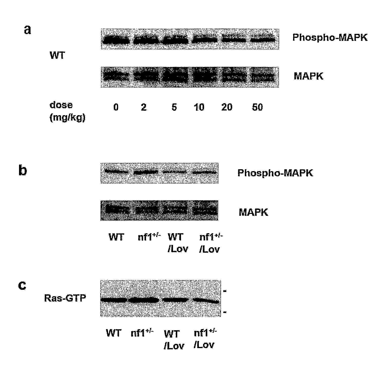 Treating learning deficits with inhibitors of Hmg CoA reductase