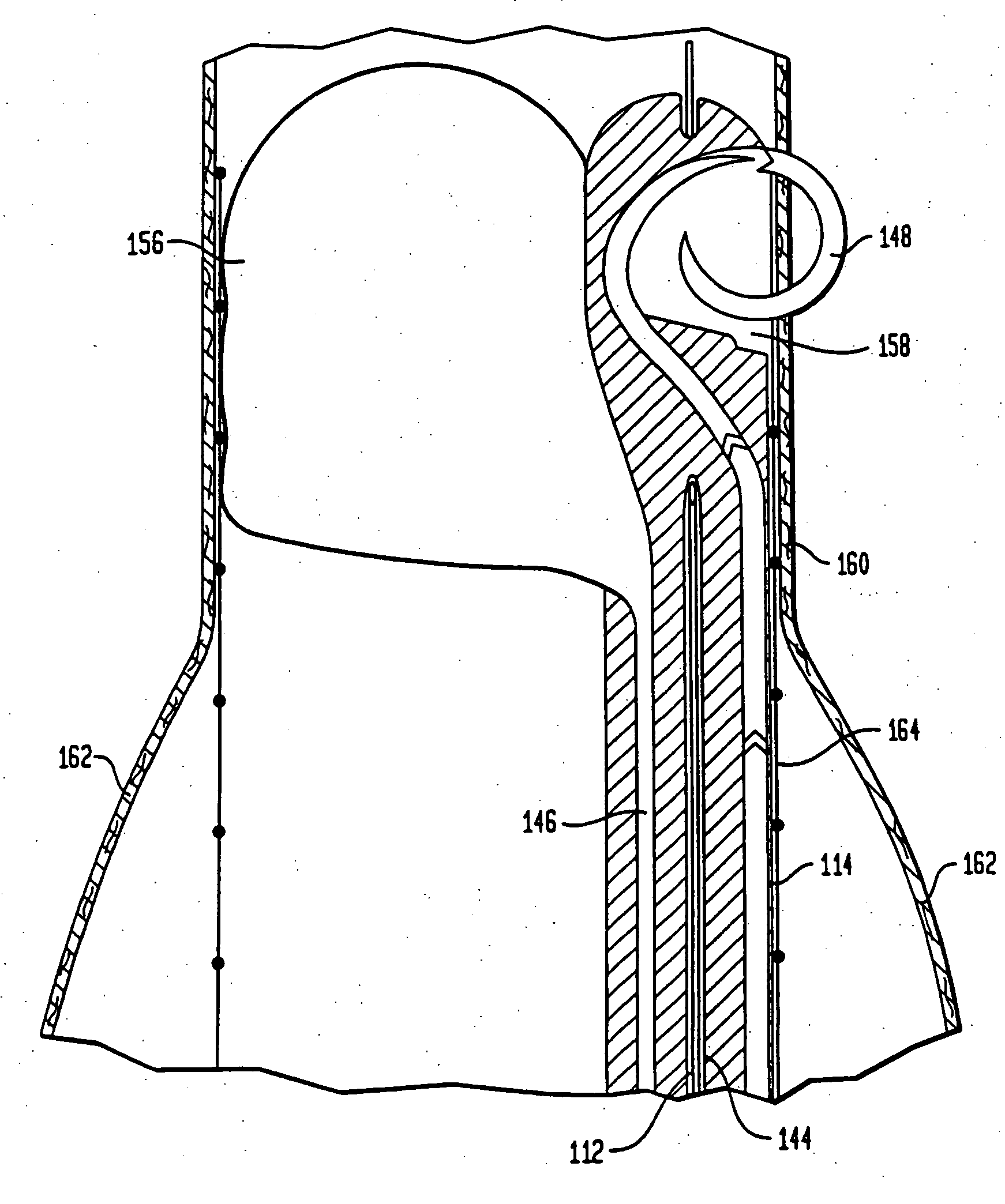 Endovascular stapler