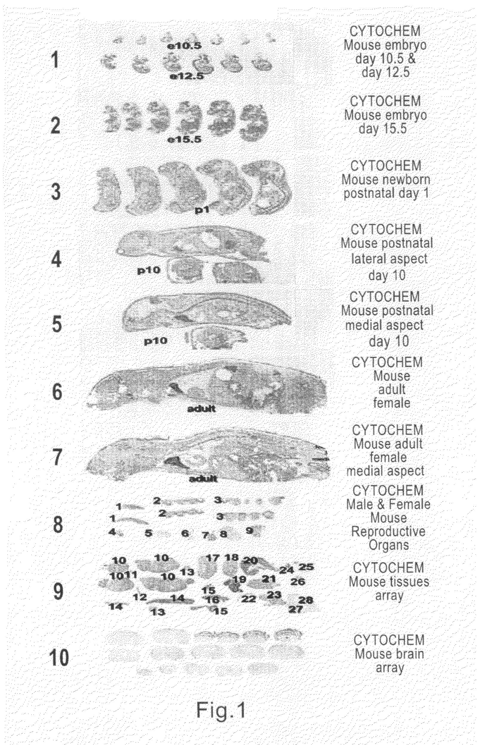 Genemap of the human genes associated with schizophrenia