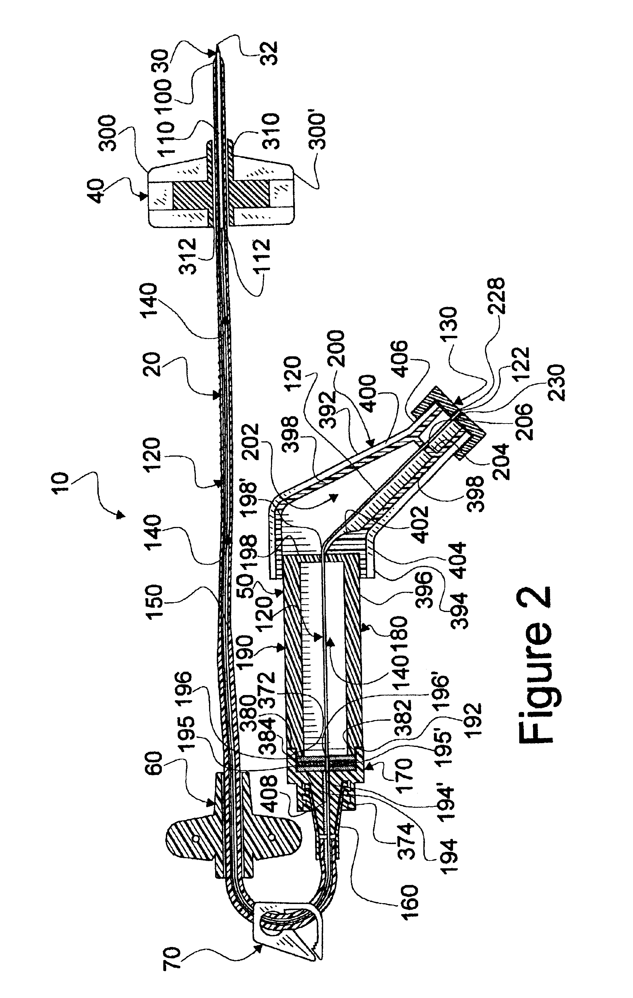 Over-the-needle safety midline catheter