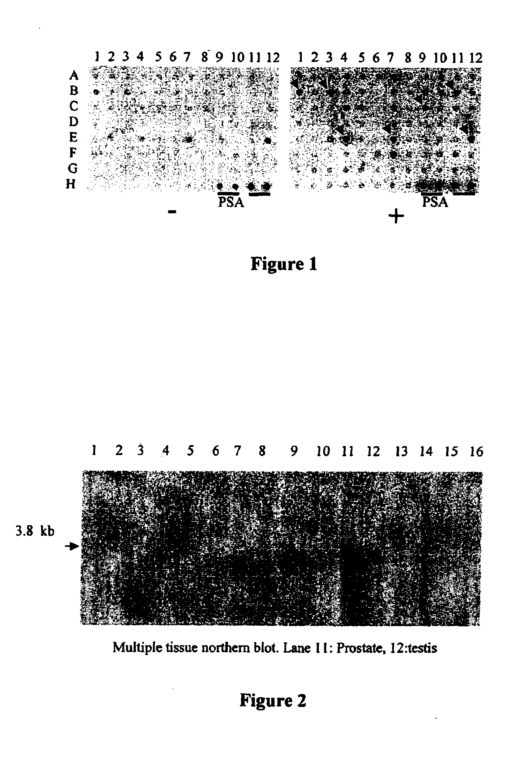 Prostate-specific or testis-specific nucleic acid molecules, polypeptides, and diagnostic and therapeutic methods