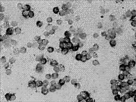 Cancer pathologic evolution early-stage GPR116 gene mRNA level in-situ hybridization detection kit, detection method and applications thereof