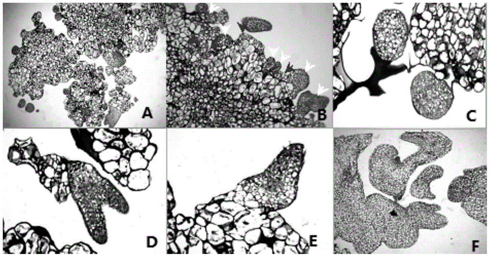 Pulsatilla tongkangensis somatic embryogenesis and plant regeneration method