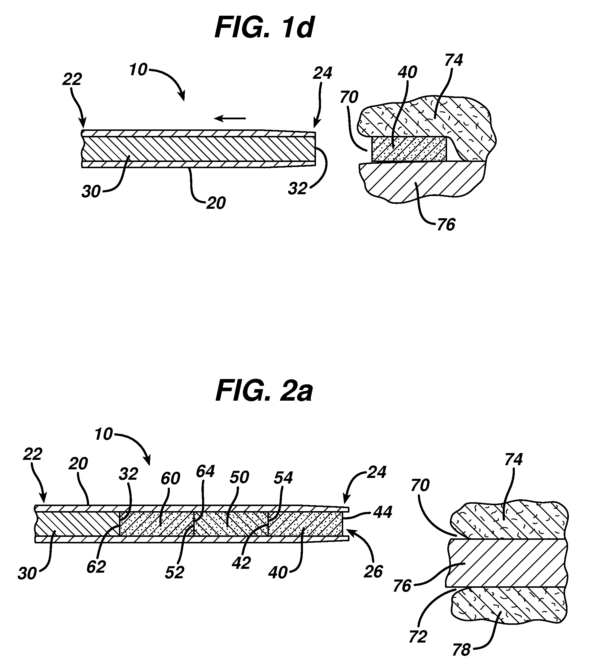 Actuators for device for delivering medicinal implants