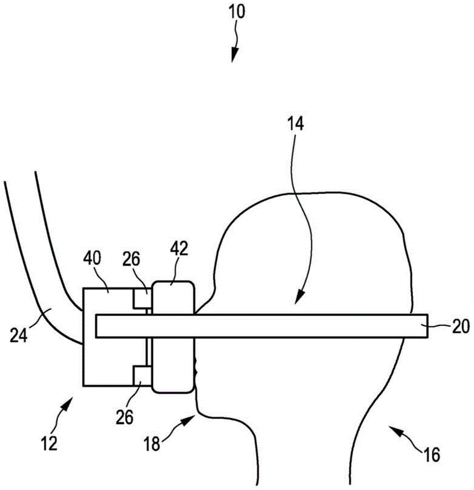 Patient interface device