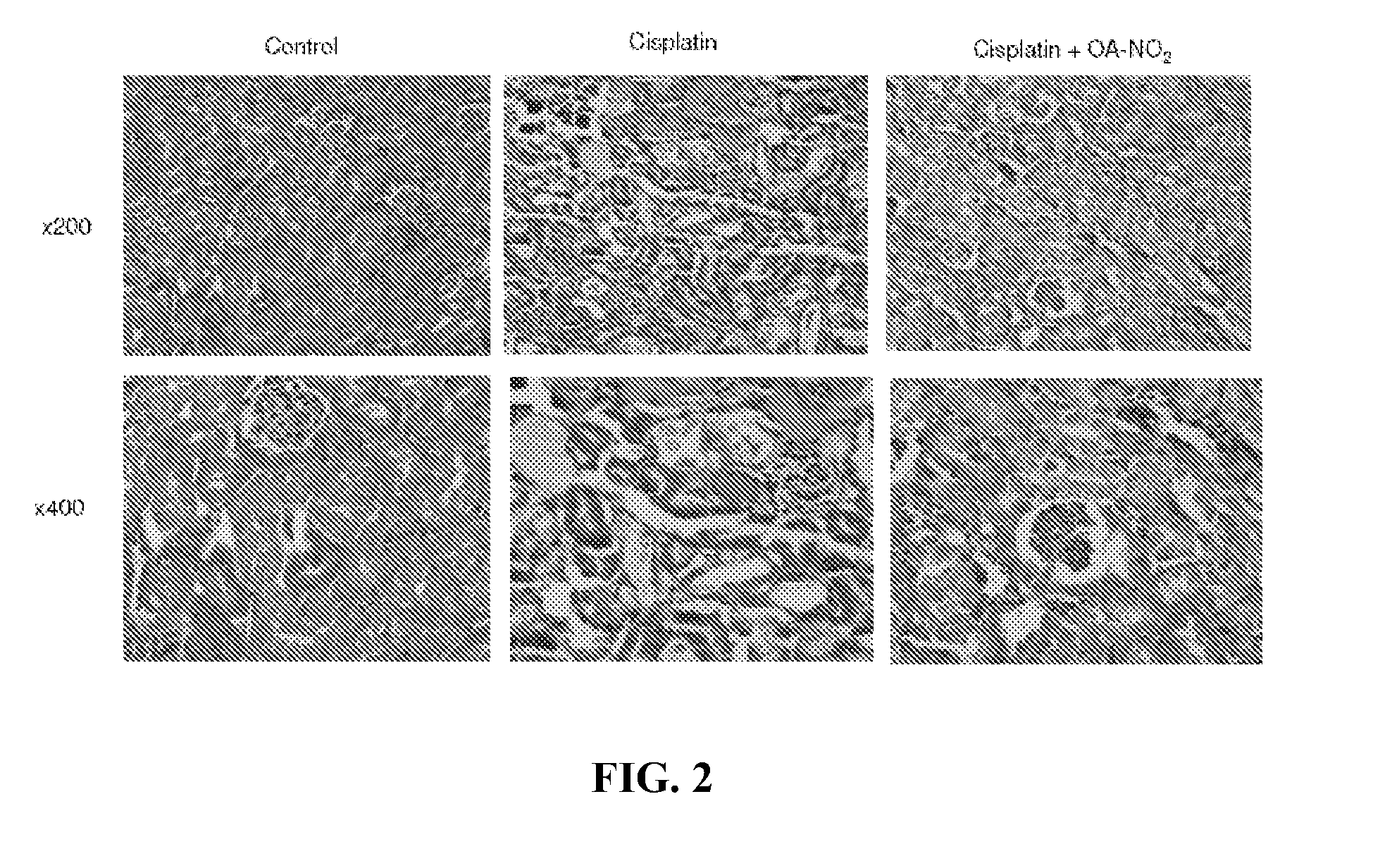 Use of nitrated lipids for treatment of side effects of toxic medical therapies