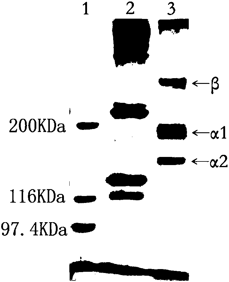 Undenatured collagen-based biosurfactant using ionic liquid as reaction medium and preparation method thereof