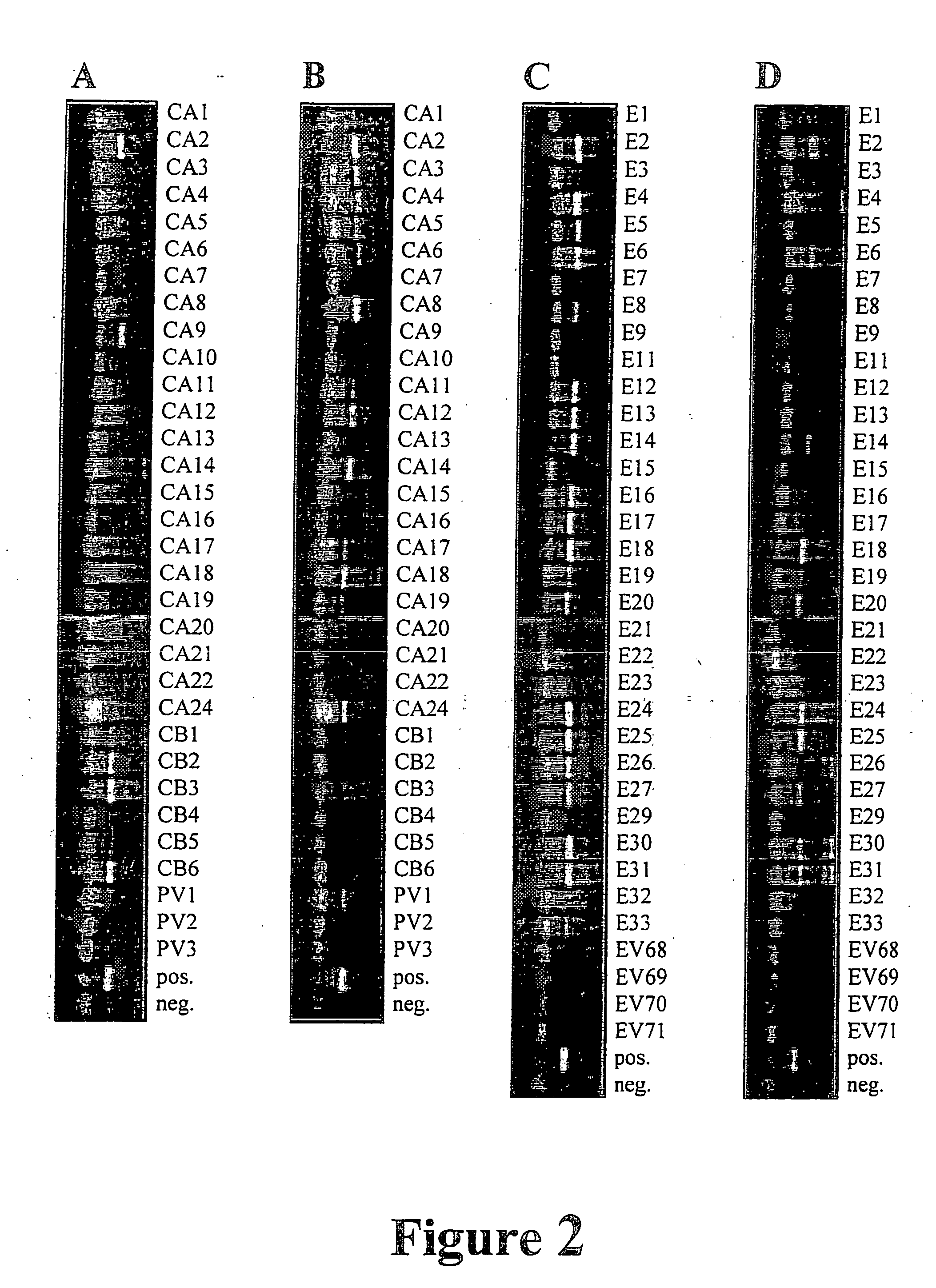 Typing of human enteroviruses