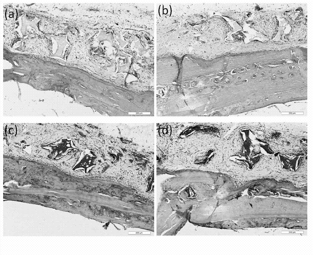 Silk fibroin base integrated osteochondral two-layer bracket, preparation and application thereof