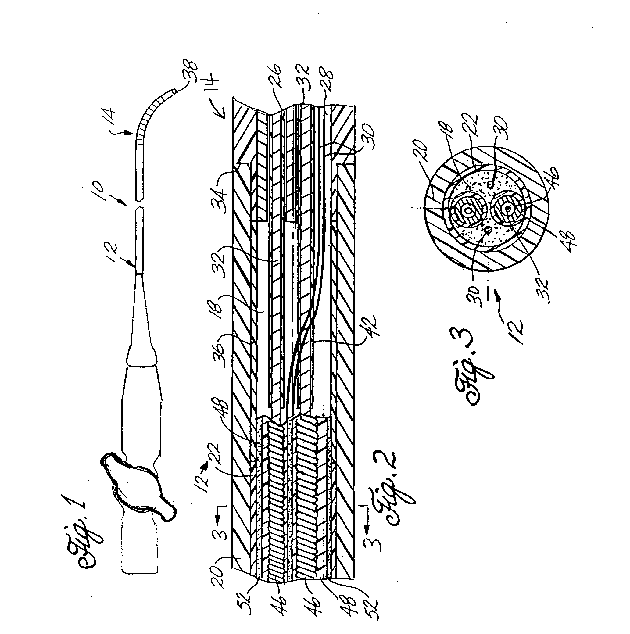 Steering mechanism for bi-directional catheter