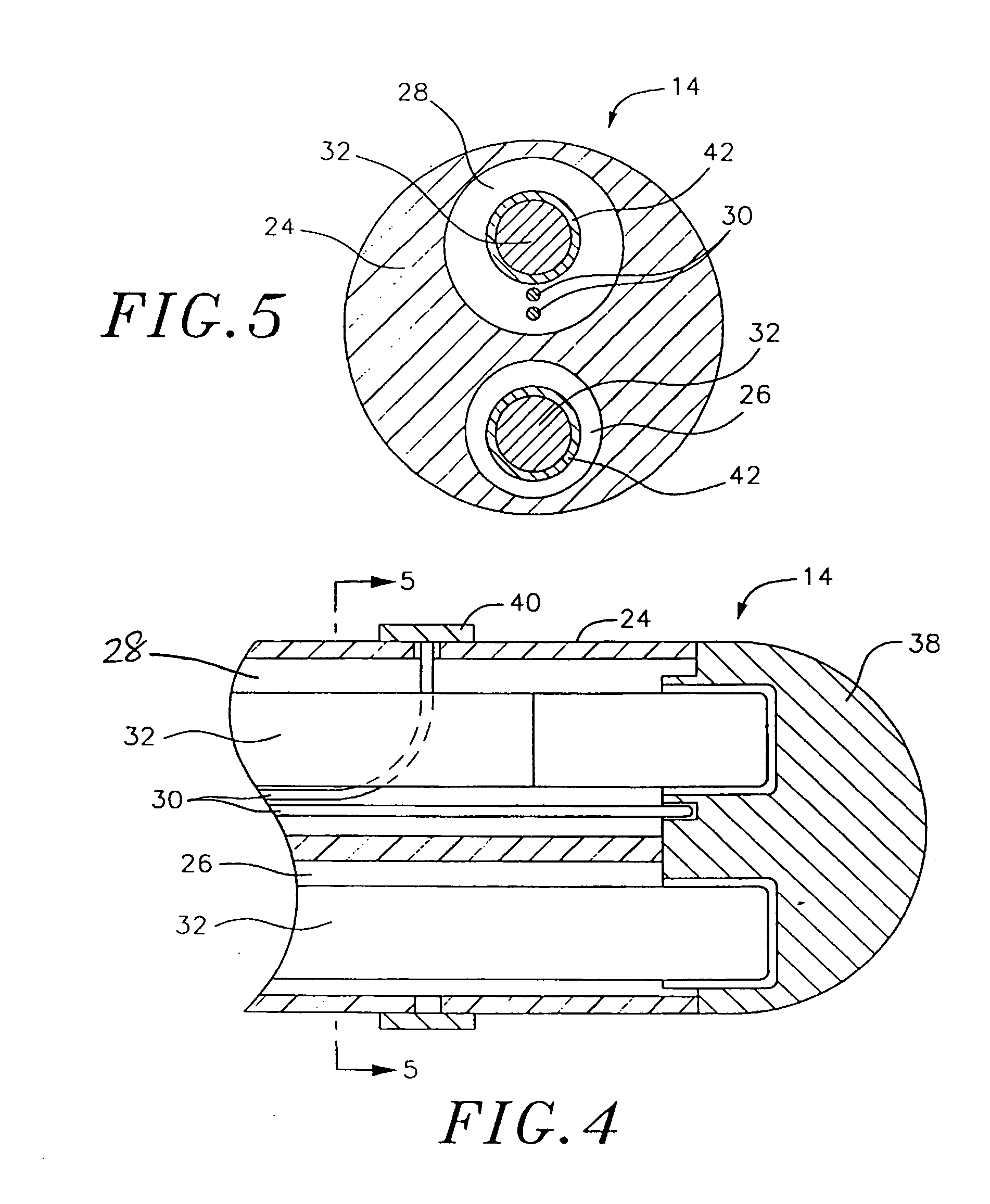 Steering mechanism for bi-directional catheter