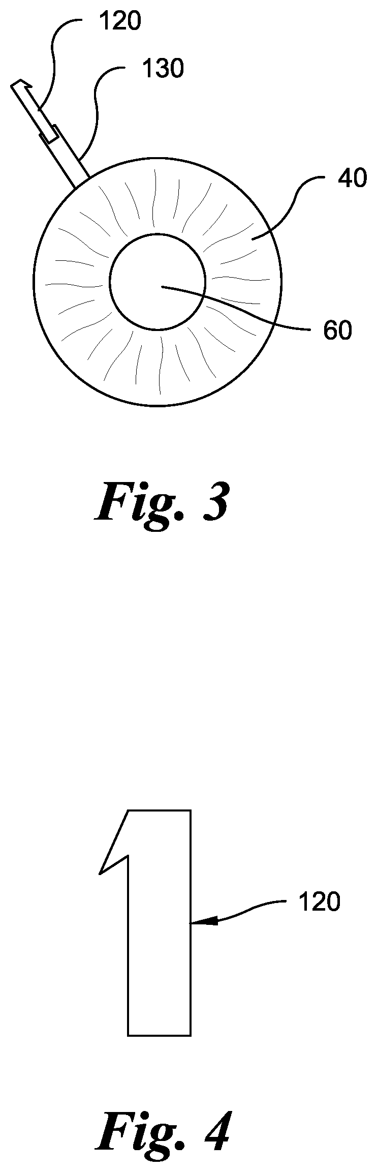 Eye implant devices and method and device for implanting such devices for treatment of glaucoma