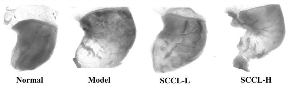 Application of sea cucumber cooking liquor dry powder in preparation of products for preventing and treating acute stomach injury