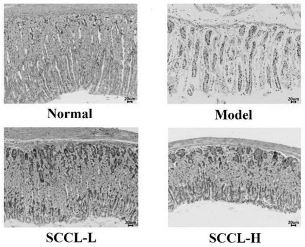 Application of sea cucumber cooking liquor dry powder in preparation of products for preventing and treating acute stomach injury