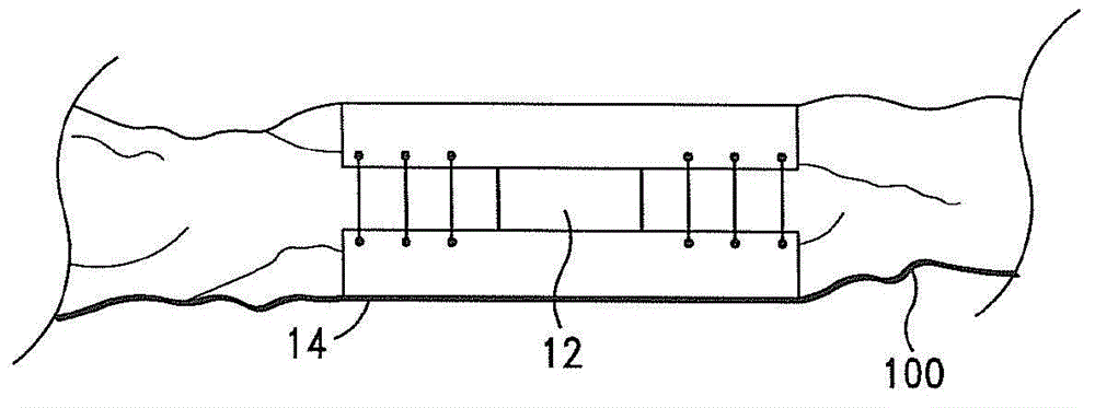 Compositions, structures and methods for neural regeneration