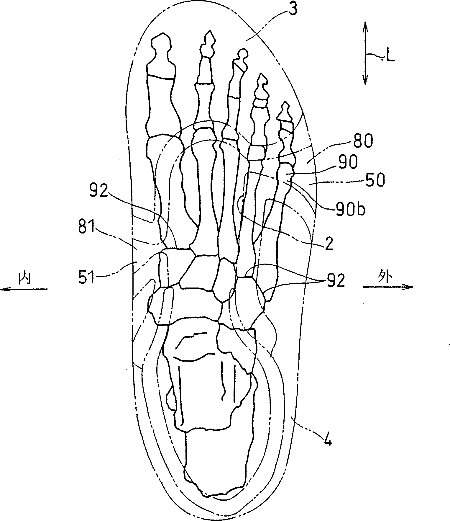 Sports shoes having upper part with improved fitting property