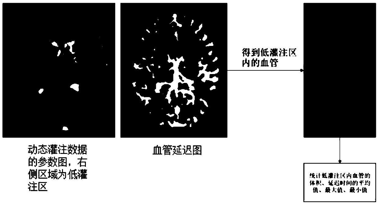 Image annotation method and system for intracranial blood flow delay