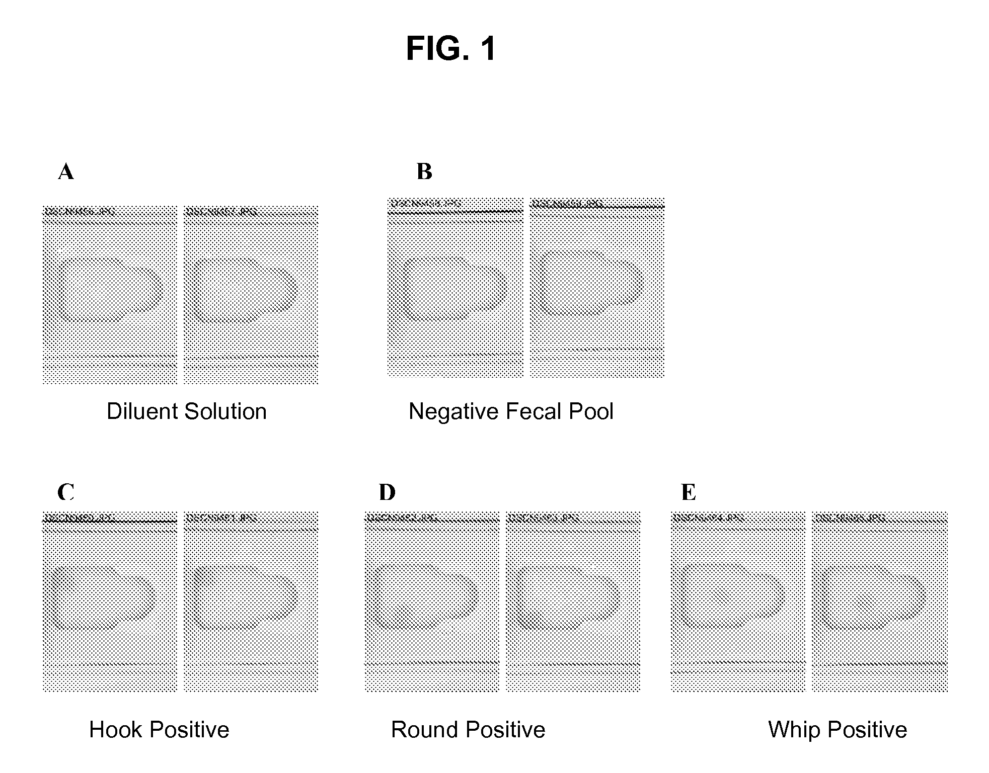 Methods, devices, kits and compositions for detecting roundworm, whipworm, and hookworm