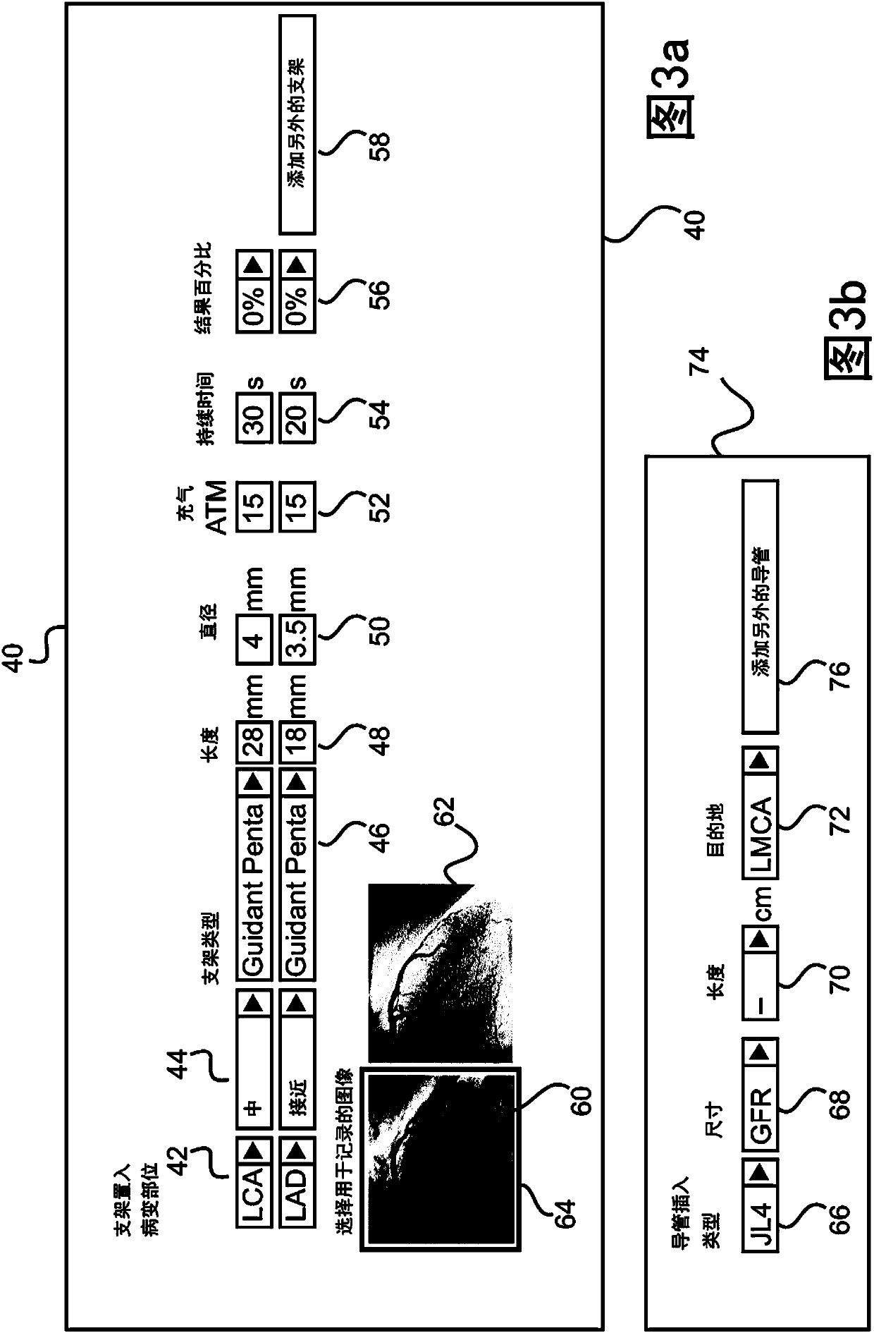 Interventional medical reporting apparatus