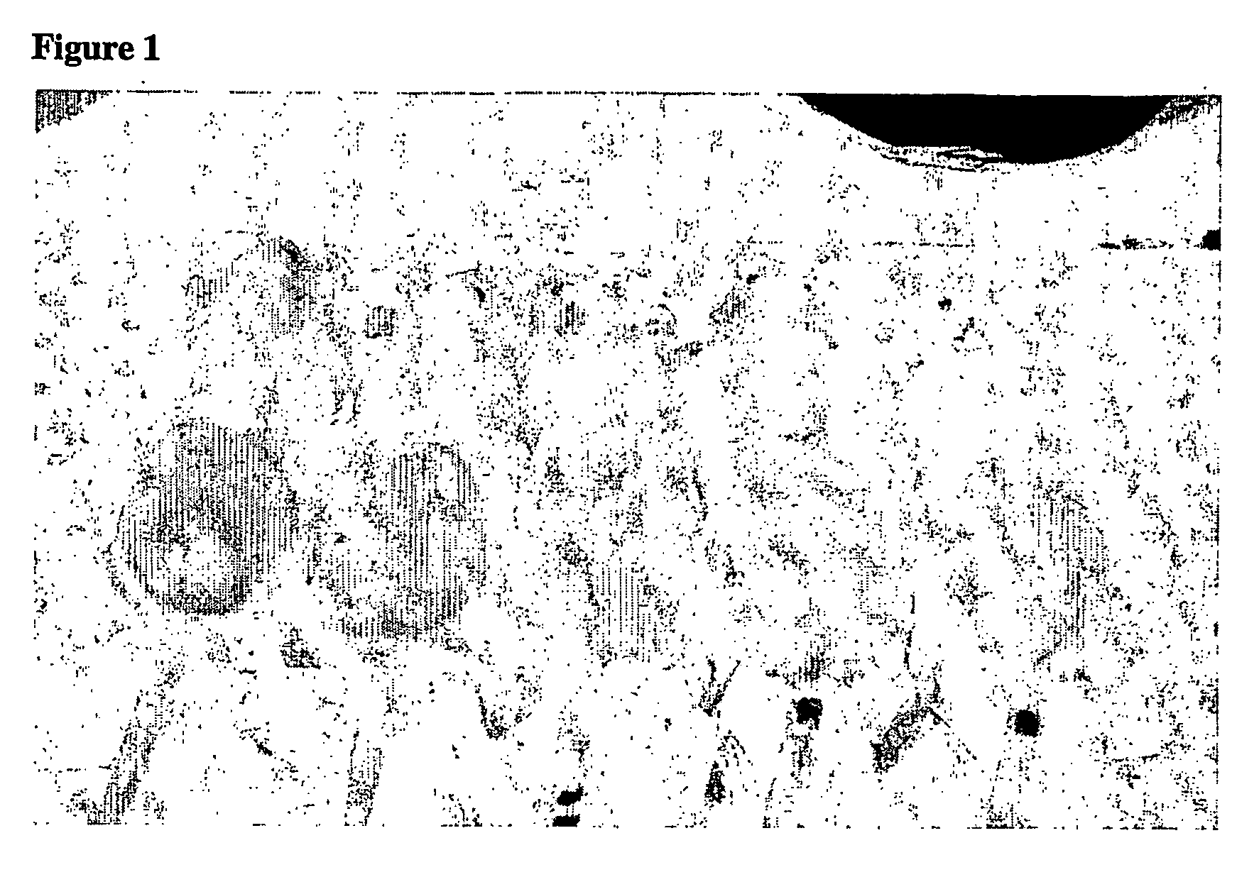 Method of treatment of systemic injury secondary to burns