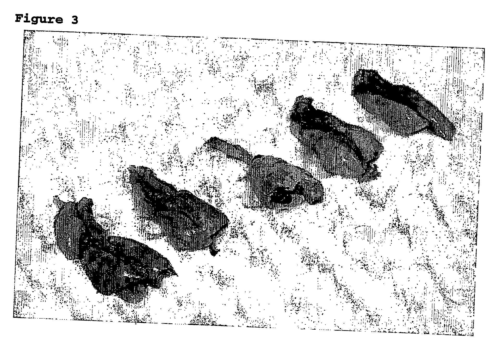 Method of treatment of systemic injury secondary to burns