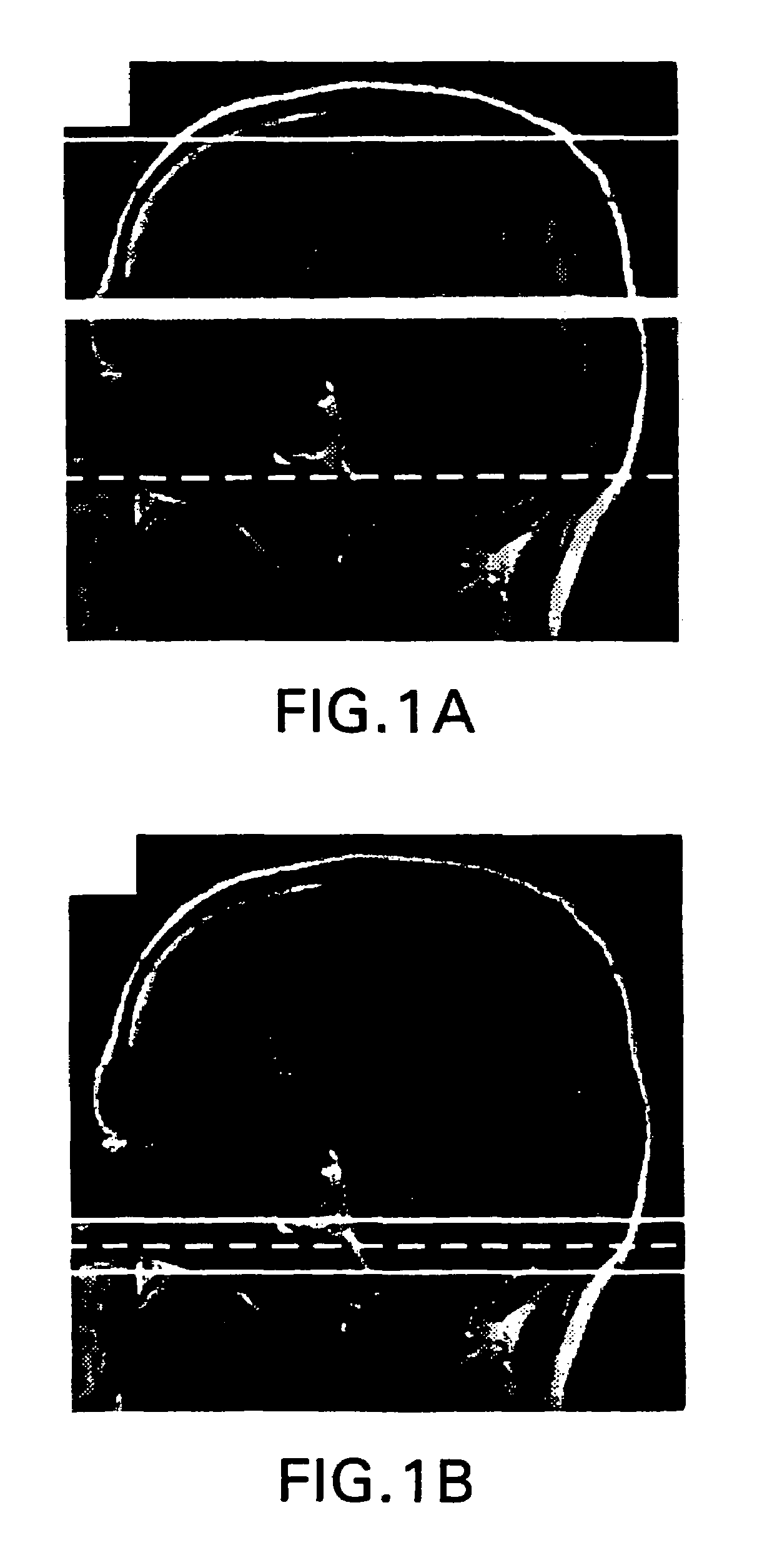 Multi-slice cerebral blood flow imaging with continuous arterial spin labeling MRI