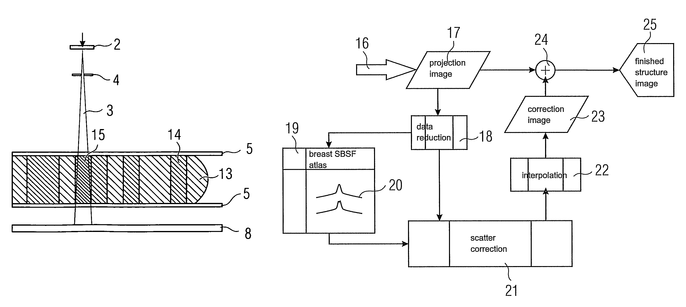 Apparatus and method for scatter correction in projection radiography