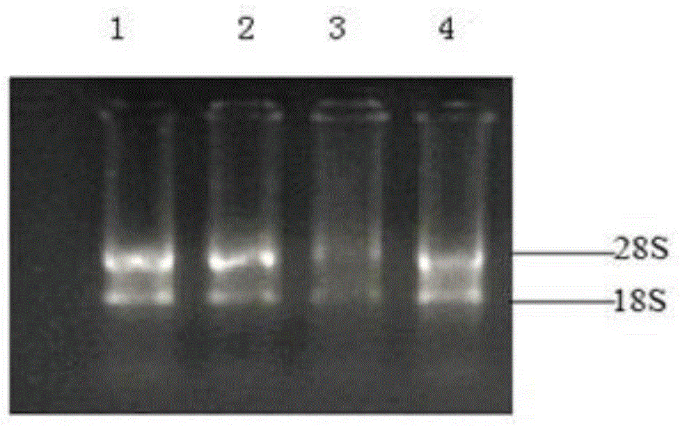 Porcine transcription factor coup-tf1, its recombinant vector and application