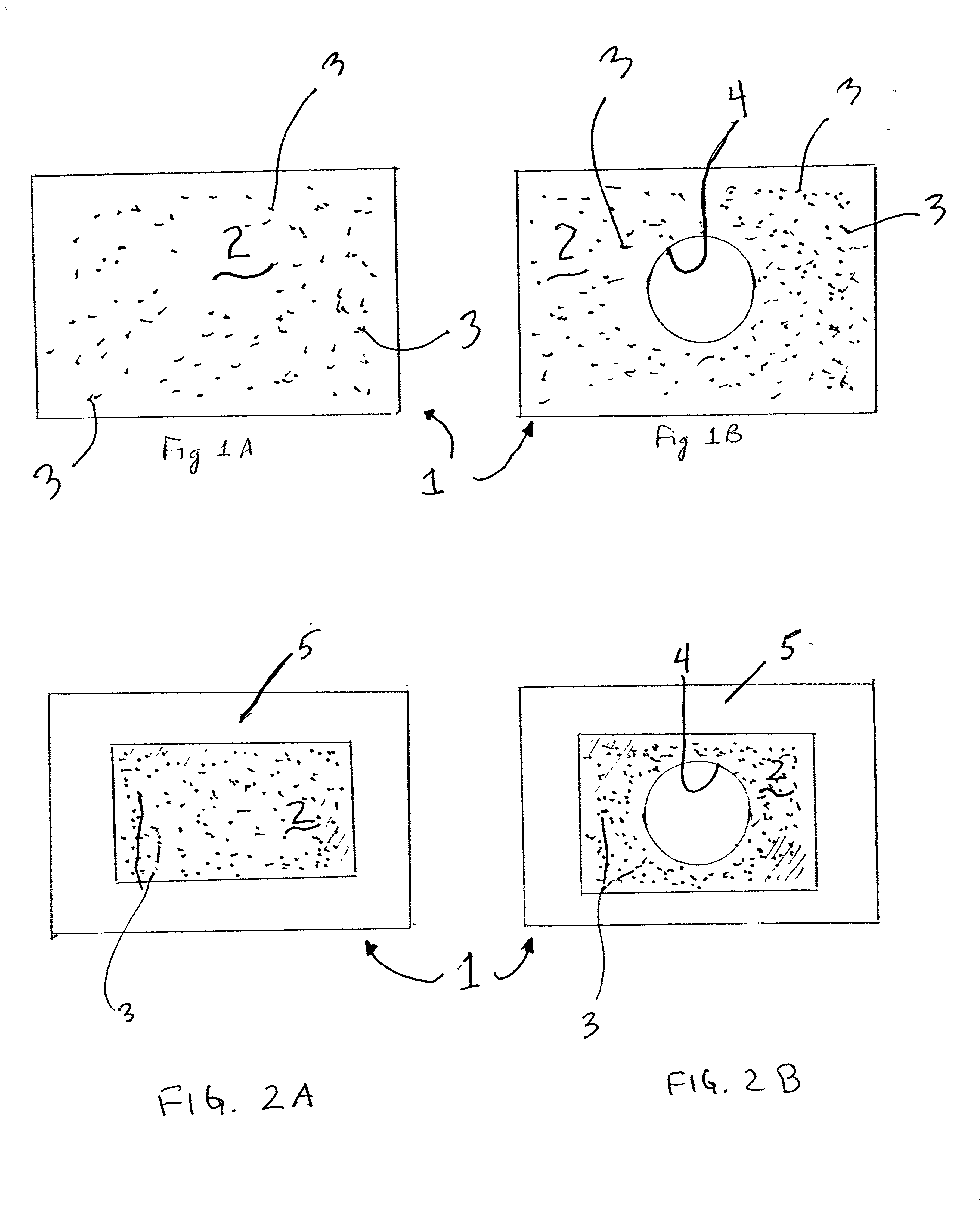 Apparatus and methods for preventing or treating failure of hemodialysis vascular access and other vascular grafts