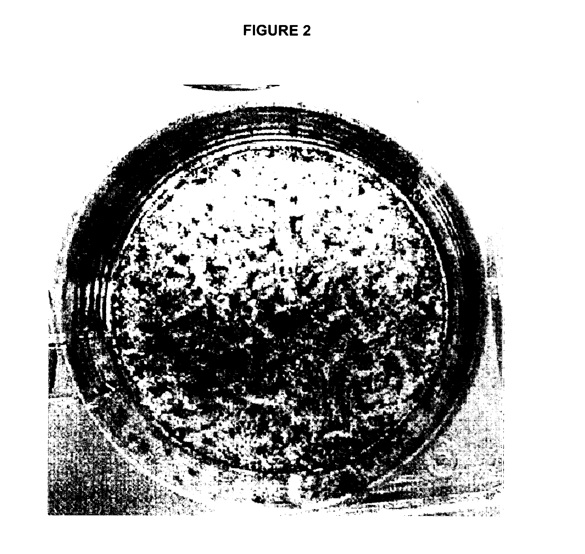 Method for osteogenic differentiation of bone marrow stem cells (BMSC) and uses thereof