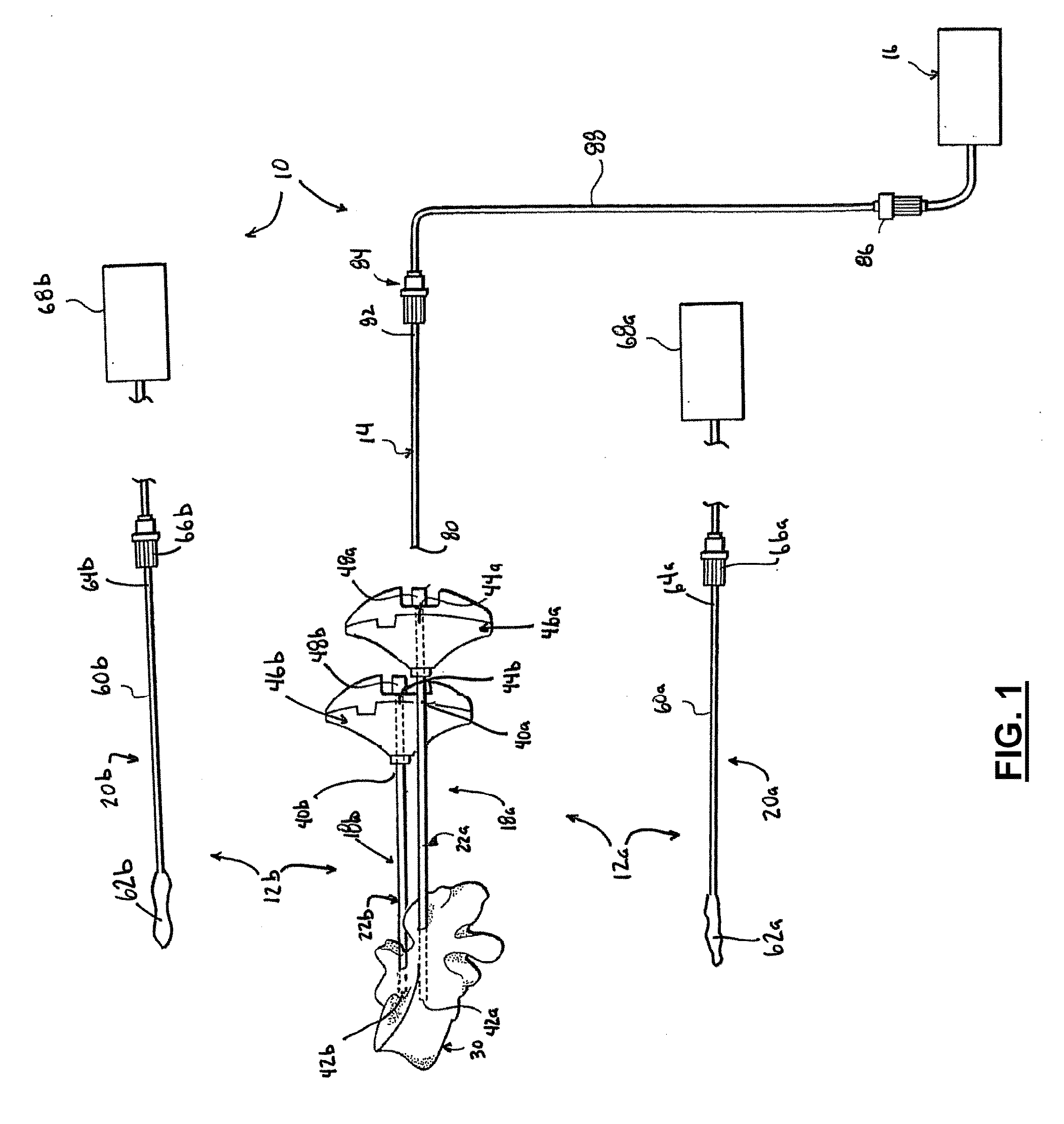 Method for balloon-aided vertebral augmentation