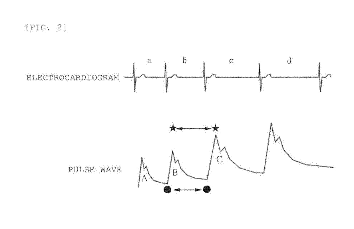 Neurogenic baroreflex sensitivity measurement device, neurogenic baroreflex sensitivity measurement program and neurogenic baroreflex sensitivity measurement method