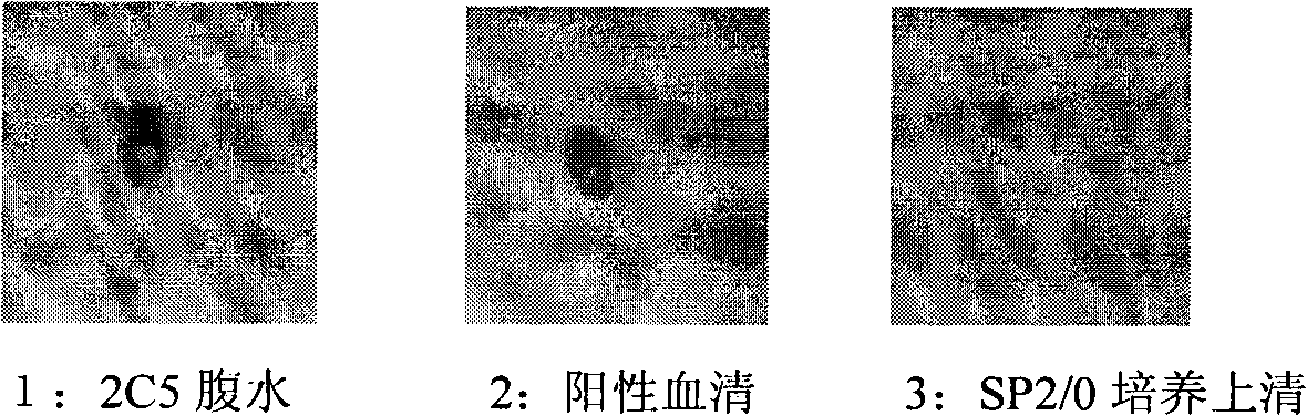 Anti-rabies virus monoclonal antibody and preparation method and application