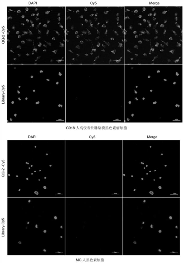 Nucleic acid aptamer QQ-2 targeting human highly invasive choroidal melanoma and application