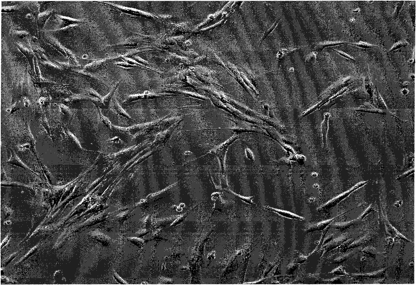 Method for inducing the differentiation of mesenchymal stem cells of human embryo livers into islet beta-like cells and stably expressing insulin and special induced liquid thereof