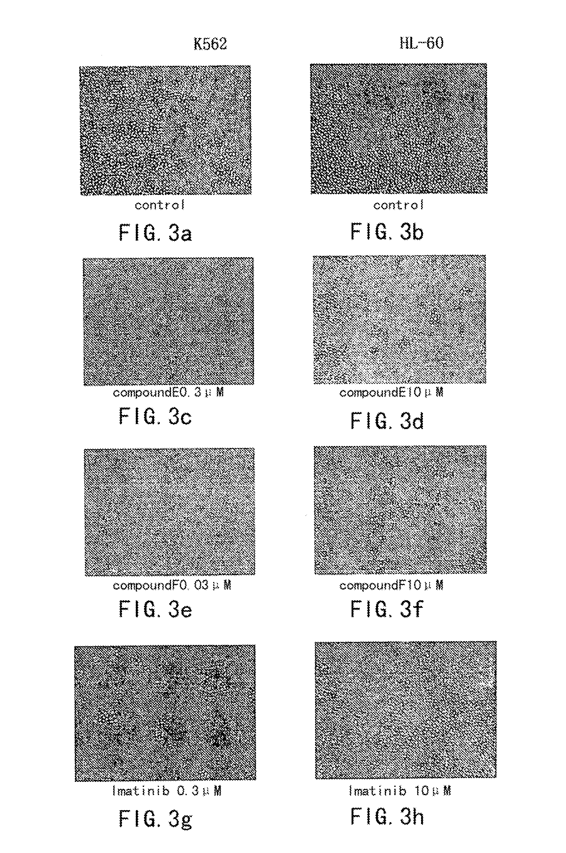 Aminopyrimidine compounds and their salts, process for preparation and pharmaceutical use thereof