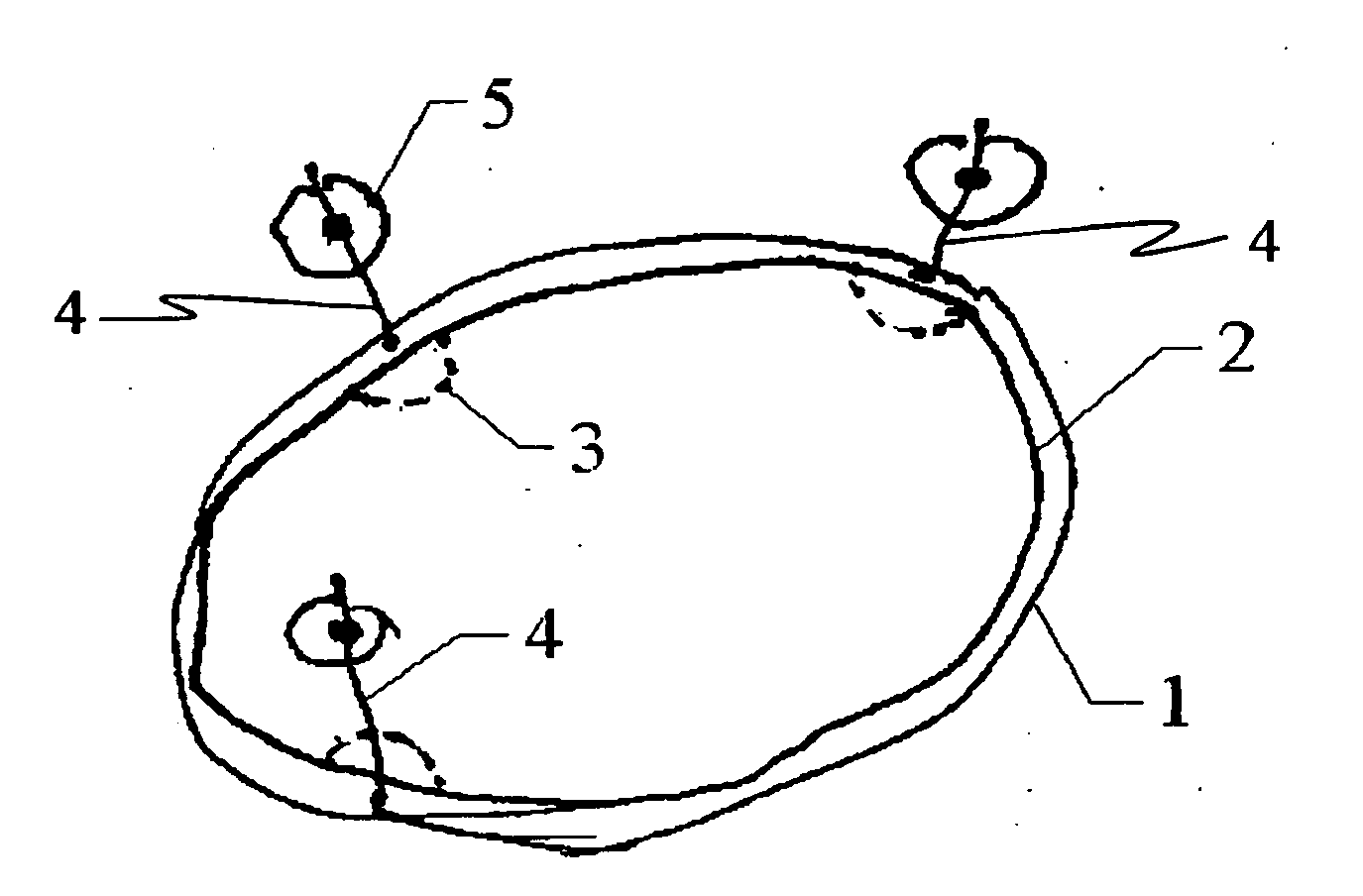 Closure Device for Skull Plates and Related Method Thereof