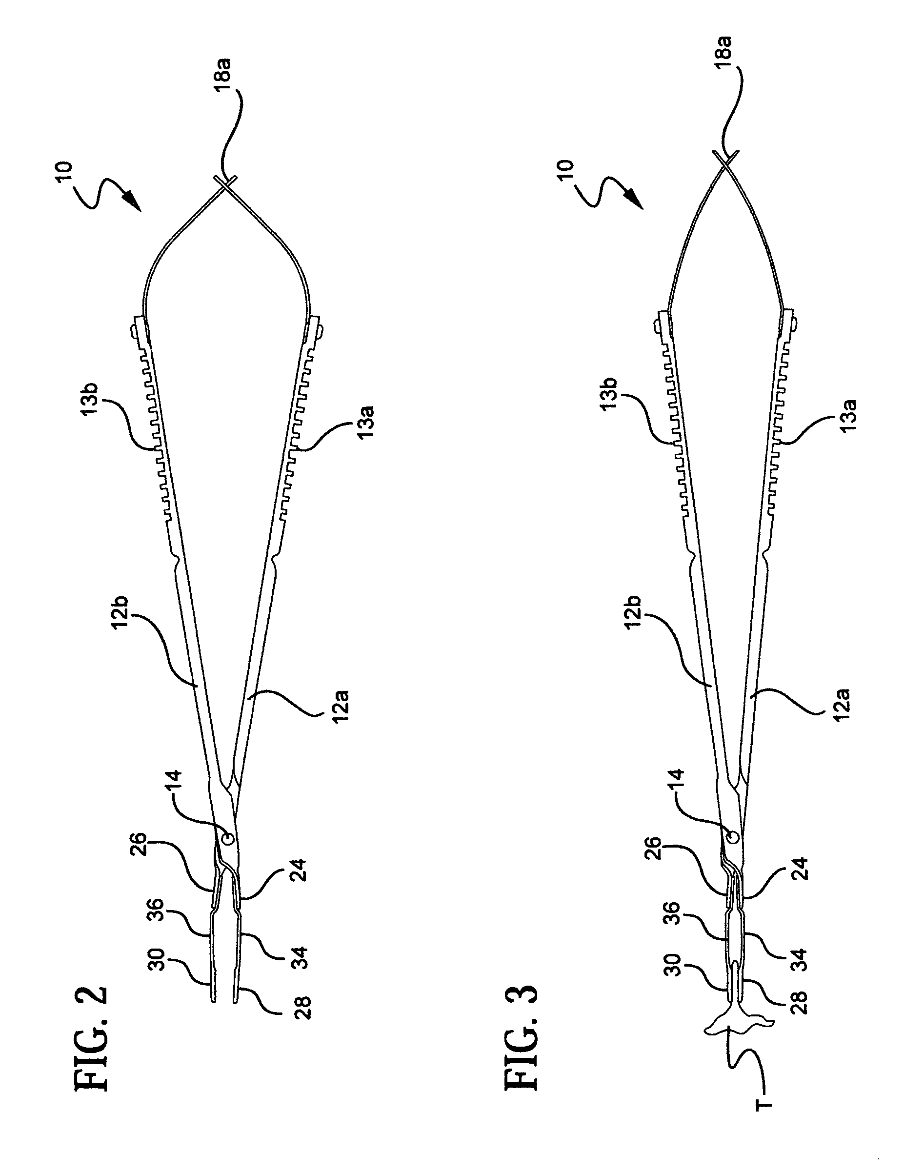 Pressure limiting forceps