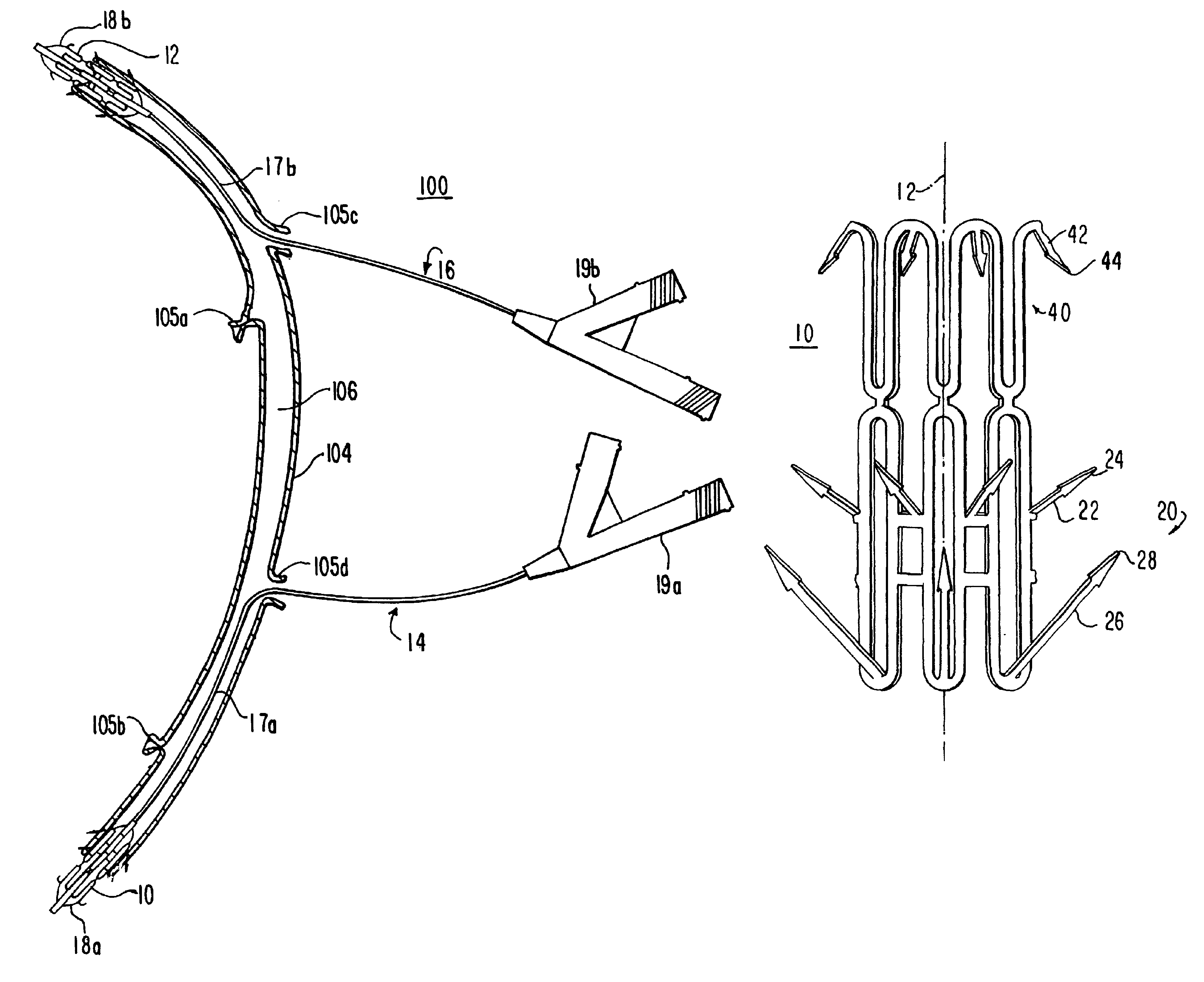 Medical grafting methods and apparatus