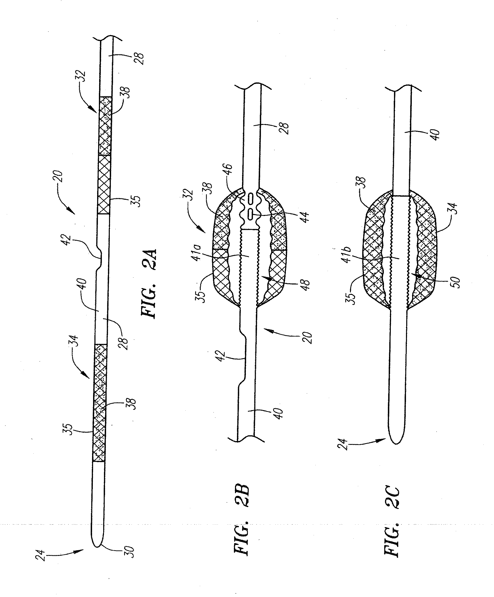 Occlusion device and method of use