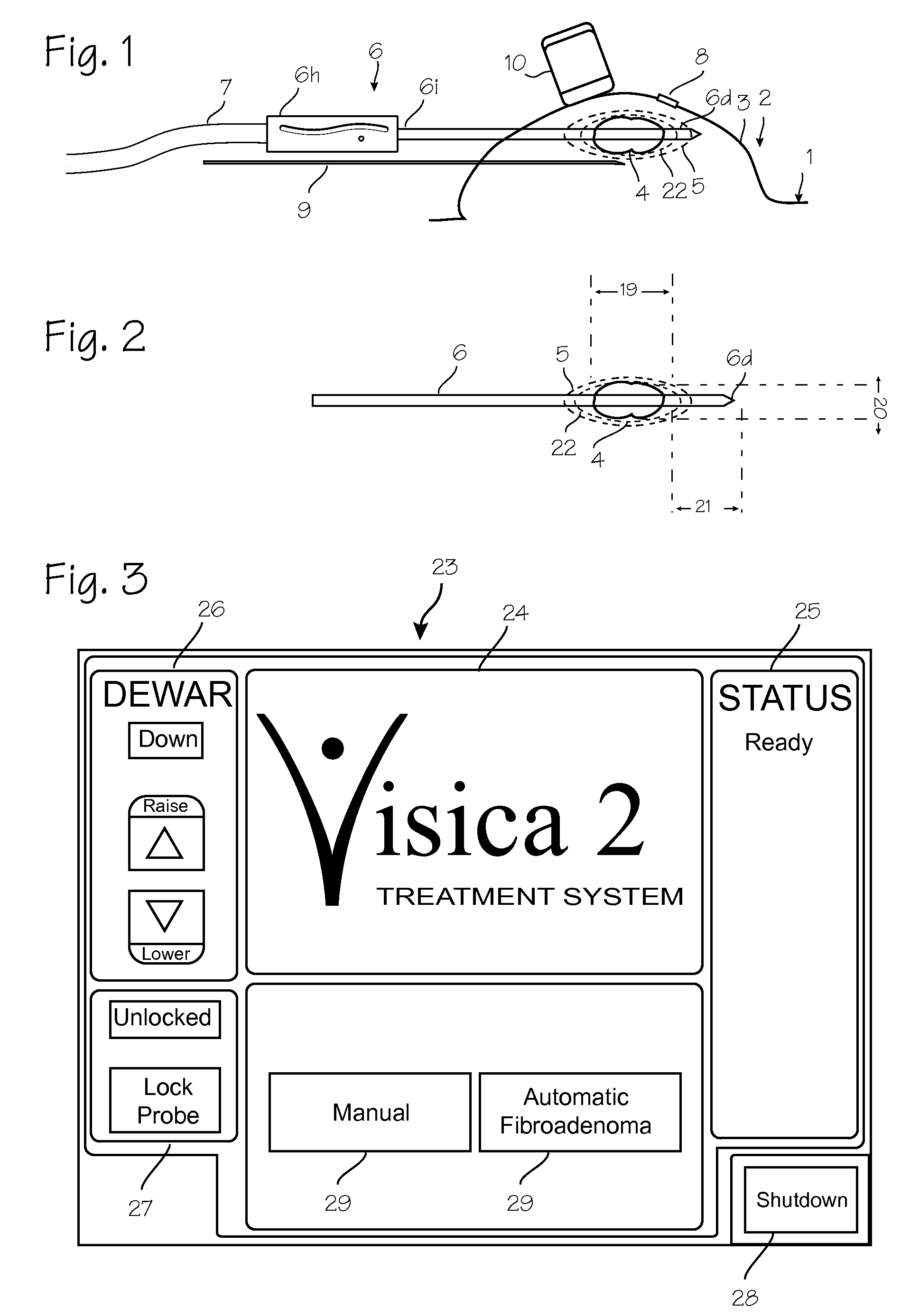 Fast Fibroadenoma Treatment System and method