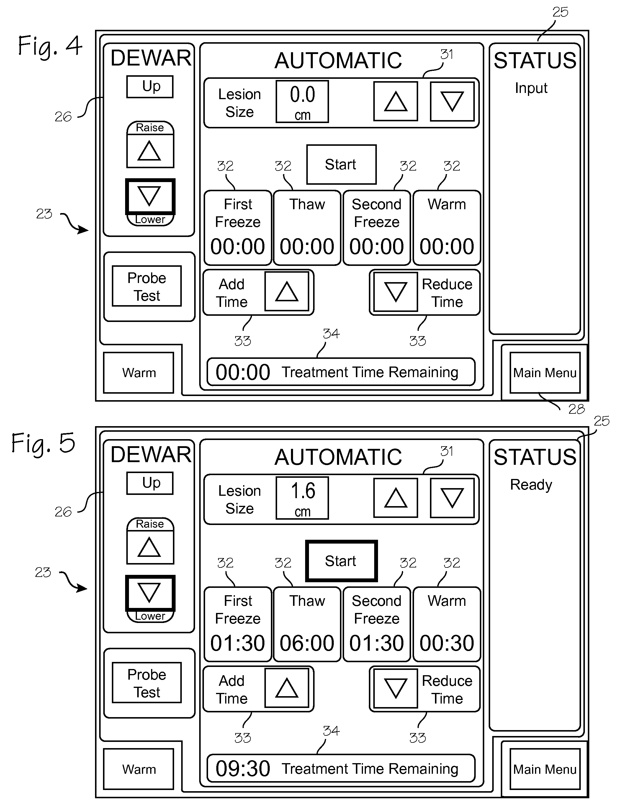 Fast Fibroadenoma Treatment System and method