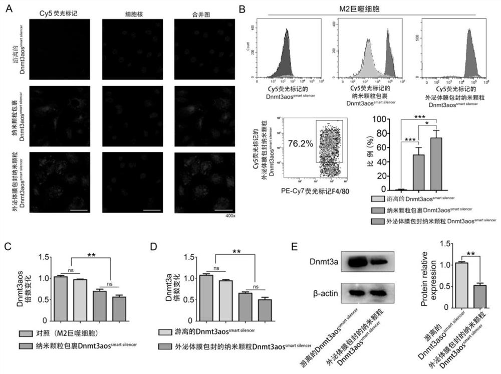 A kind of macrophage exosome membrane-coated biomimetic nanoparticle and its preparation method and application