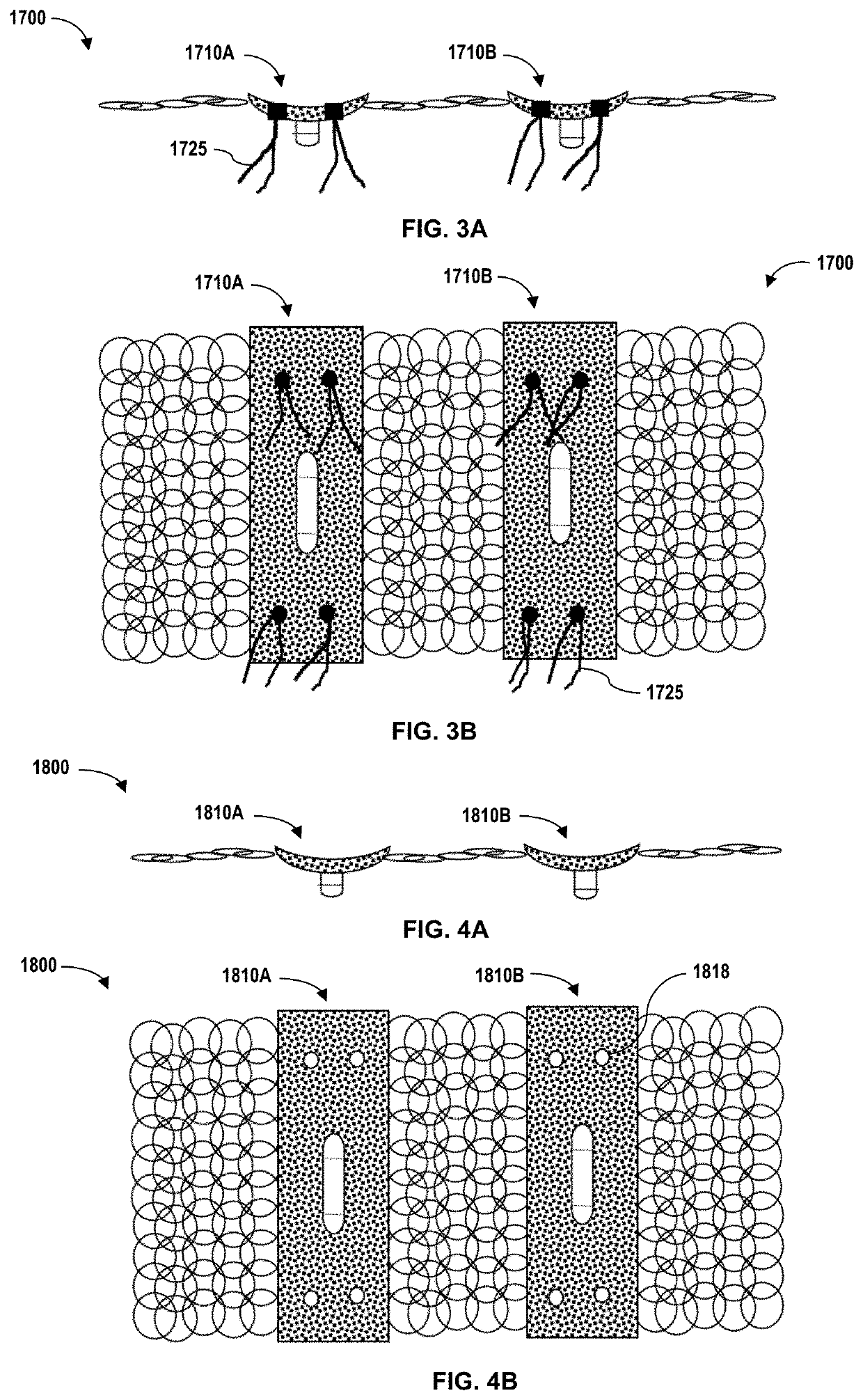 Flexible construct for femoral reconstruction